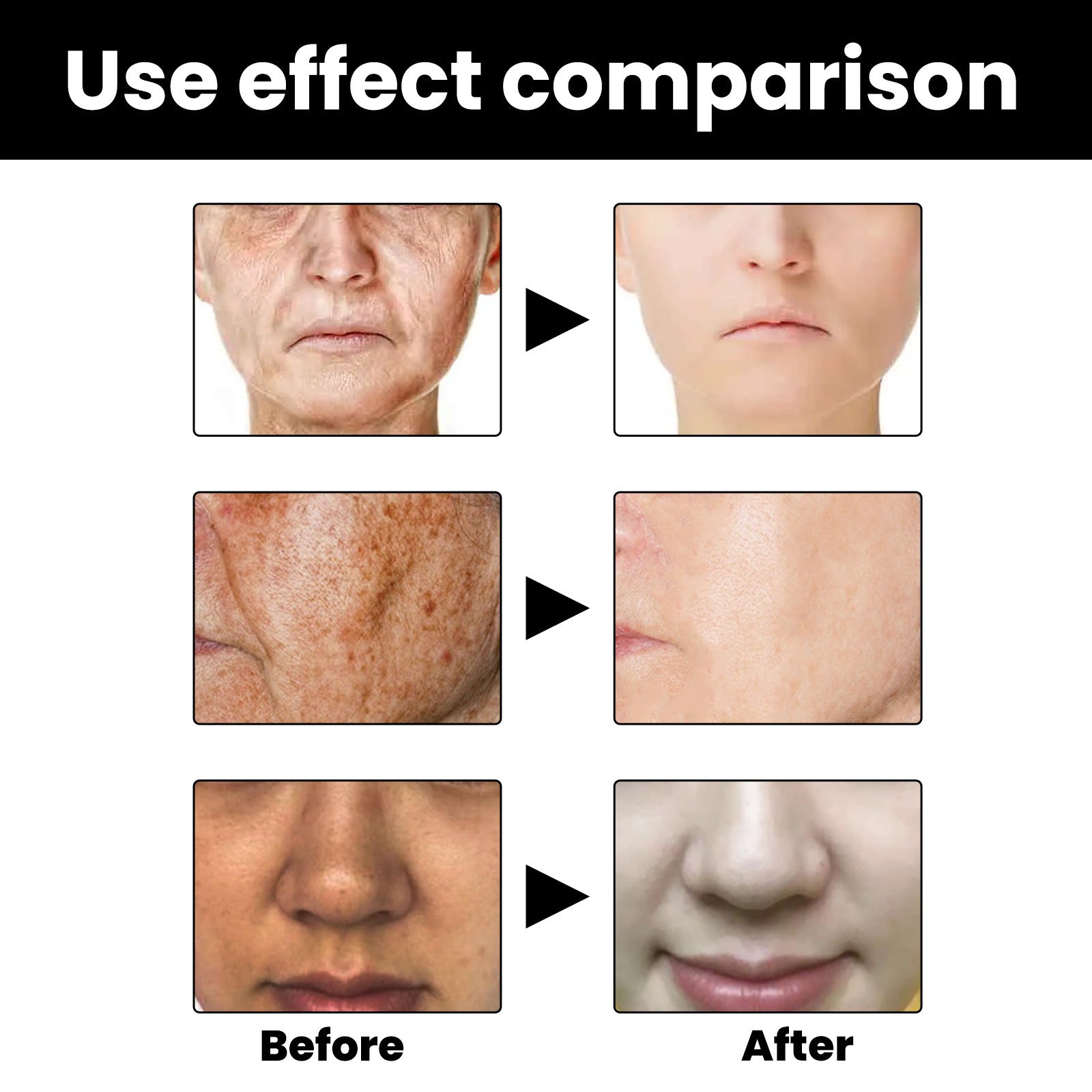 Facial Melanin Repair Hydrating Skincare Products
